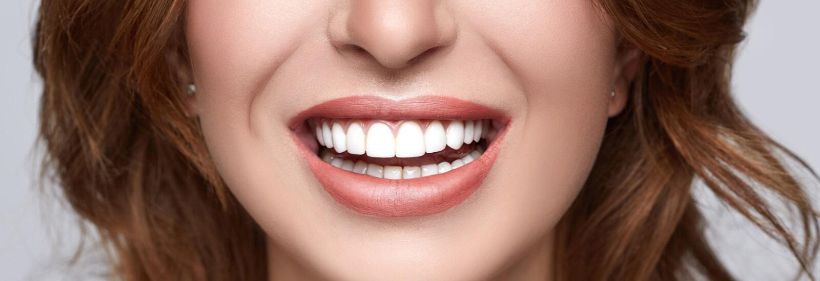 Cosmetic dentistry smile makeover