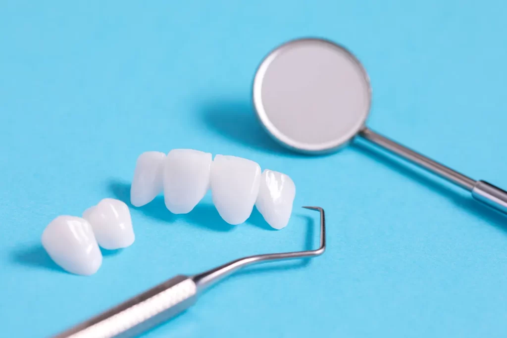 Dental veneers being placed
