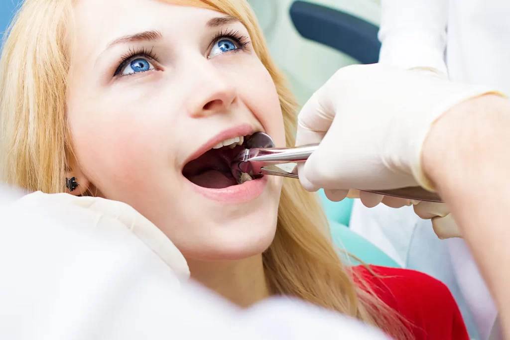 Wisdom teeth extraction process